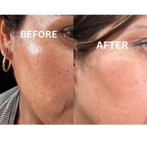 Co Q10 Face Serum ANTI-AGING, Vitamin Rich & Antioxidant Facial Oil,